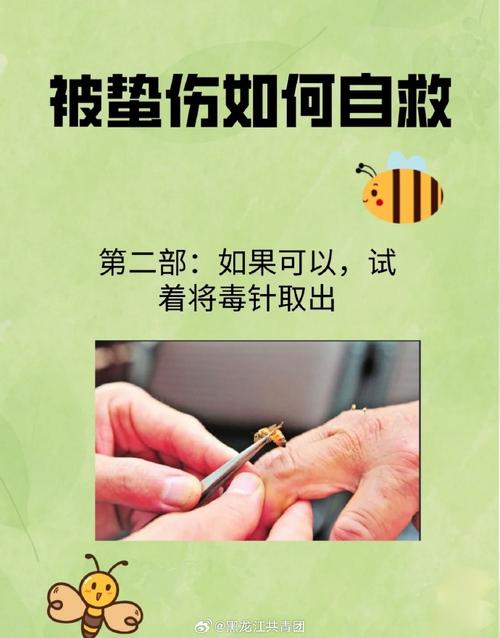 蜂蜇后留毒刺处理？镊子平拔 + 碘伏消毒步骤​