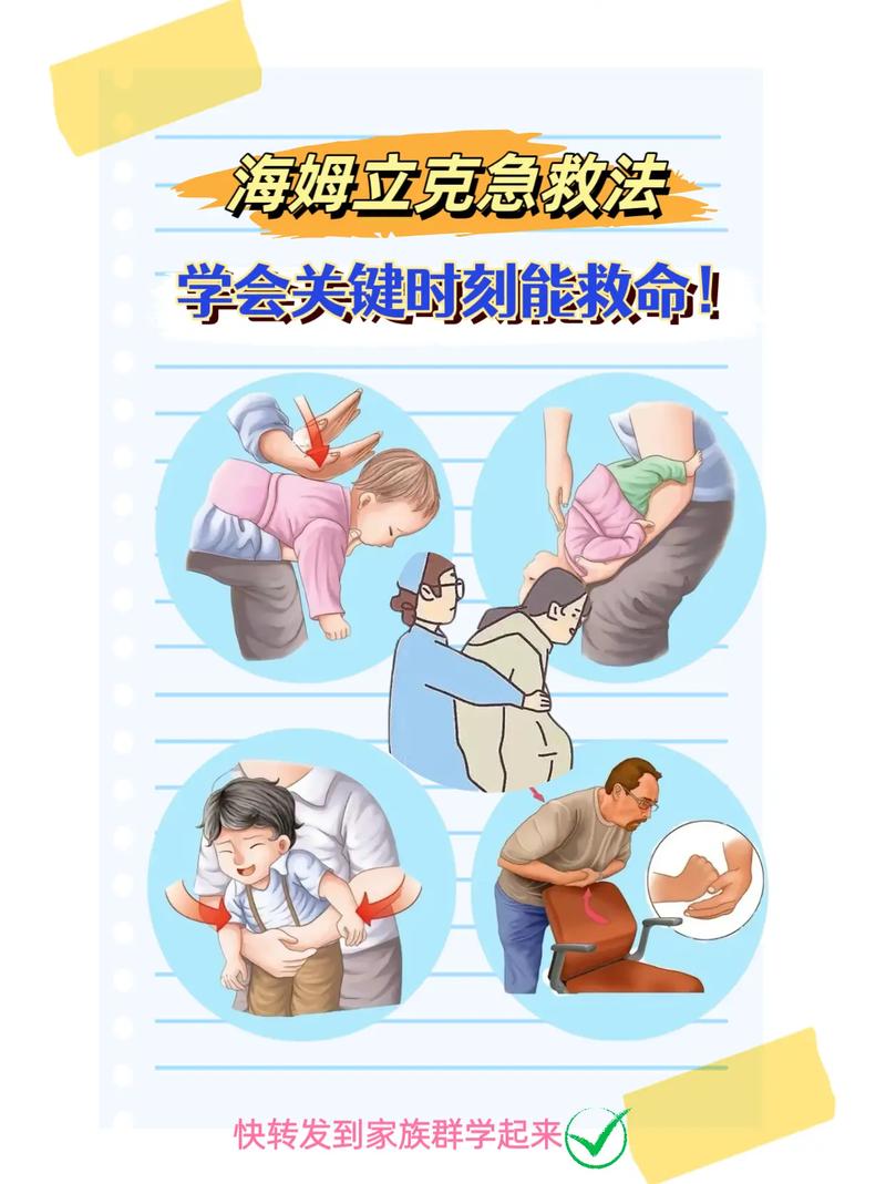 误食异物别催吐！海姆立克急救法成人版操作​