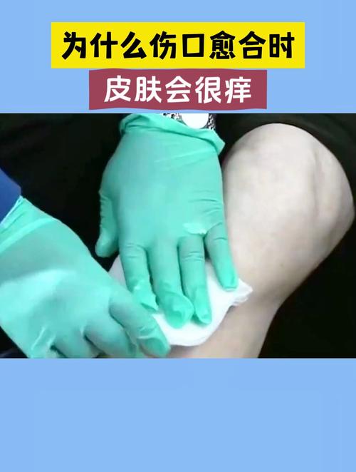 伤口愈合时为什么会痒？