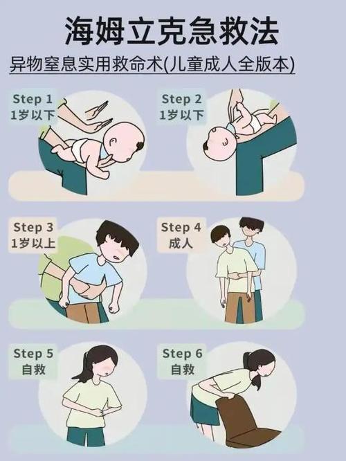 异物卡喉自救法：教你用椅子完成海姆立克​