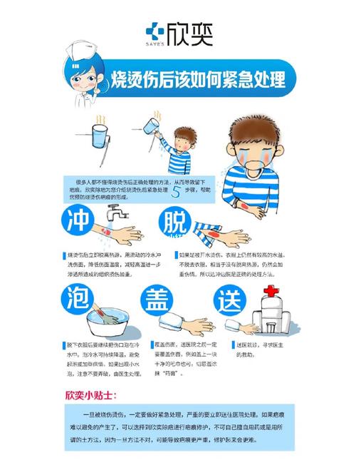应对烫伤烧伤：紧急处理的正确步骤