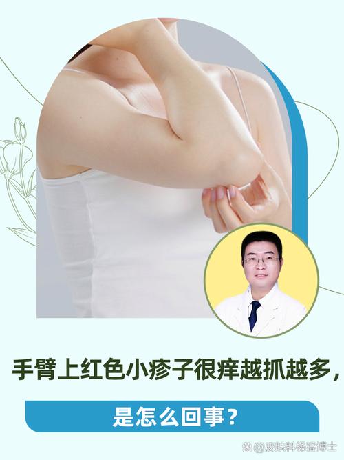 被蚊子咬后为什么越挠越痒?