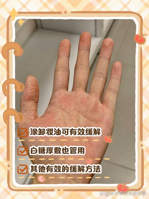 切辣椒后用牛奶洗手vs酸奶洗手？辣感残留