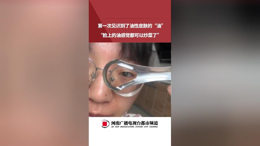 炒菜时油溅到皮肤怎么办？3步急救法