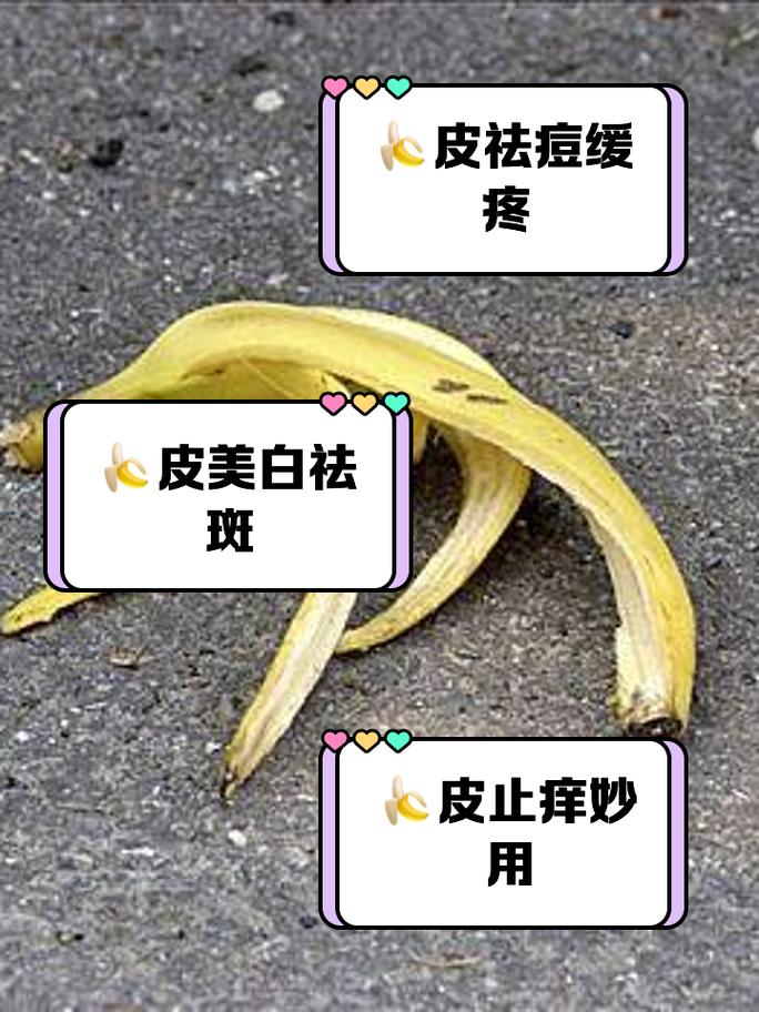 香蕉皮敷脸后需要洗脸吗？