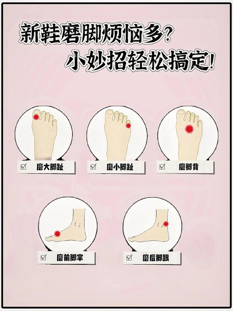 鞋子磨脚后跟?这个方法解决问题