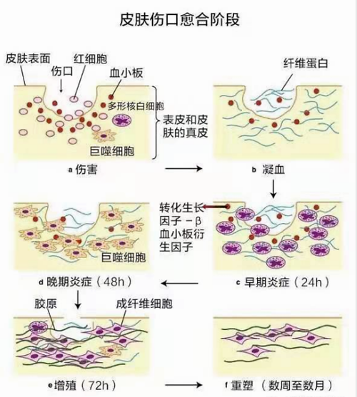 伤口愈合发痒的细胞学原因
