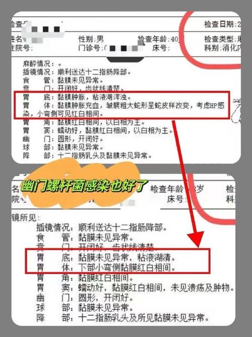 抗生素和消炎药有什么区别？