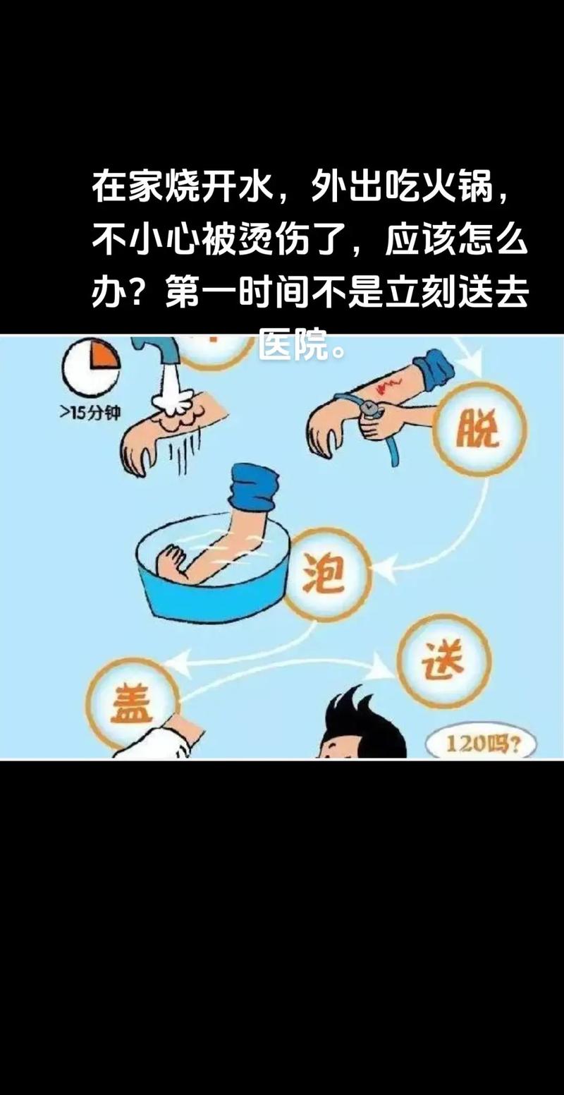 被烫伤后第一步该做什么？90%的人都做错了