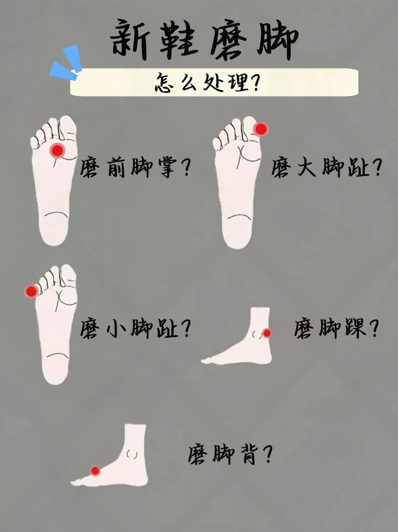 鞋子磨脚？这个方法让鞋立马变合脚