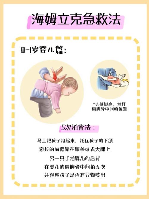 食物卡喉窒息时，海姆立克急救法这样用