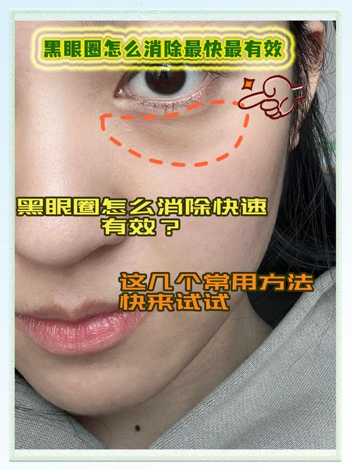 三招教你快速消除黑眼圈