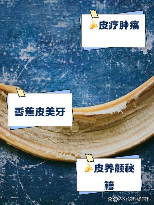 香蕉皮别扔！清洁皮具、浇花等6大妙用