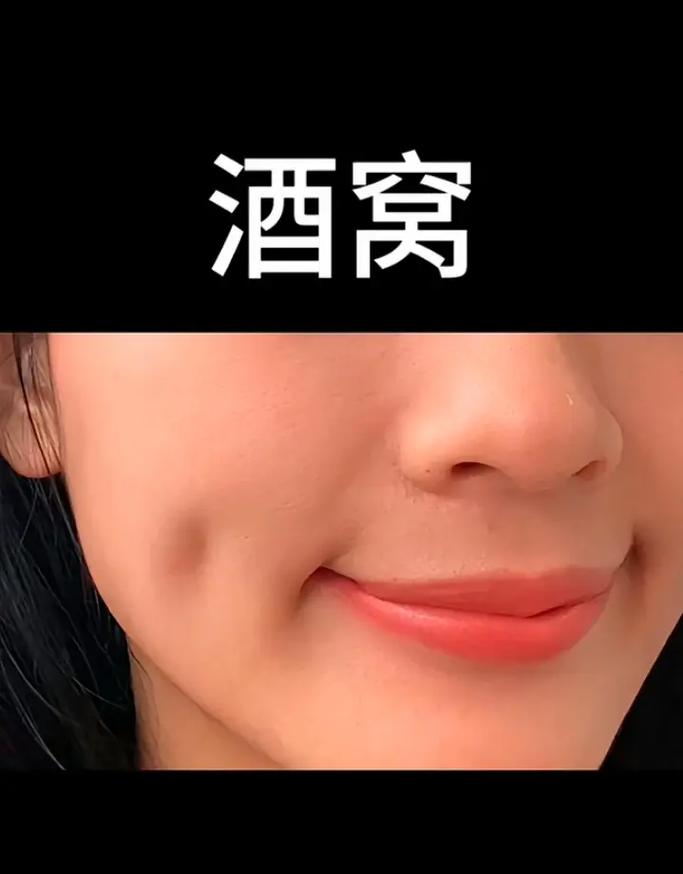 为什么人会有酒窝?