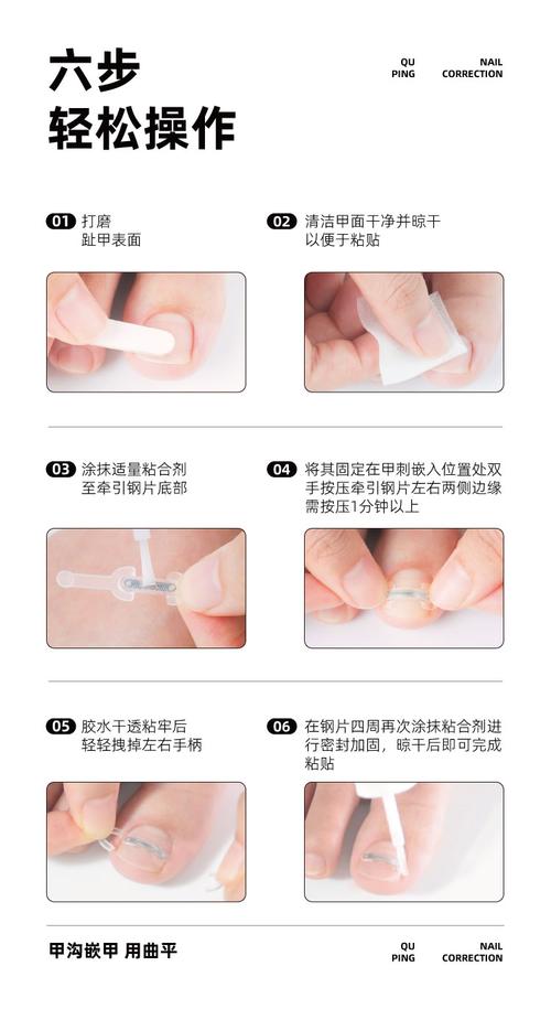 指甲刀弹簧脱落怎么办?重新卡入卡槽固定