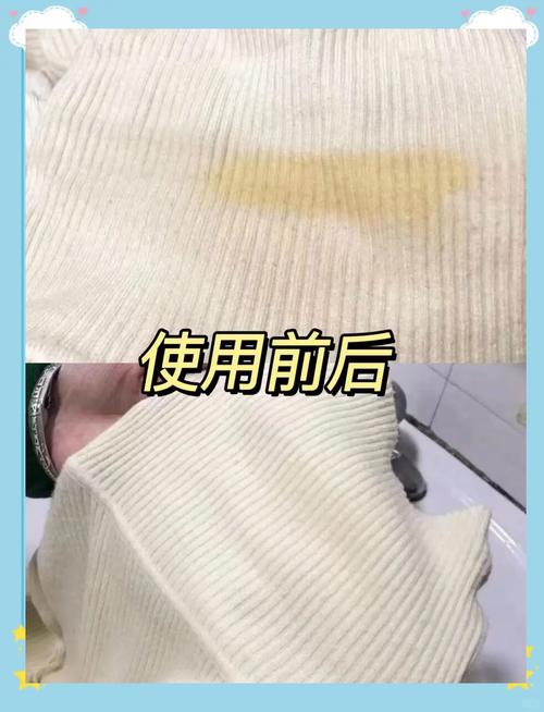 如何去除衣服上的炼乳渍?