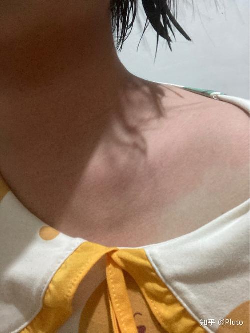 新衣服领口标签刺脖子怎么办？
