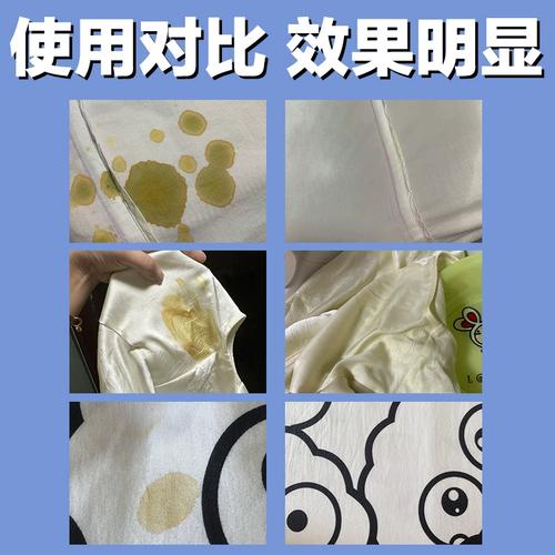 衣服上的碘酒污渍怎么去除？
