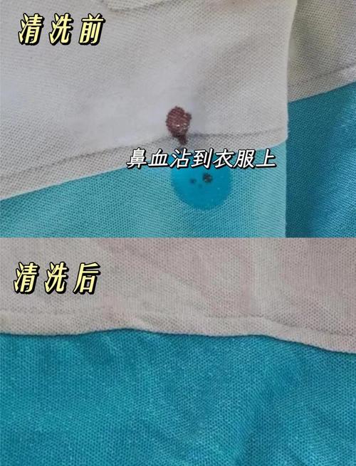 用柠檬汁去除衣服上的血渍，效果显著