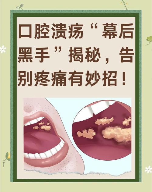 口腔溃疡怎么办？维生素 B2 碾粉涂抹患处