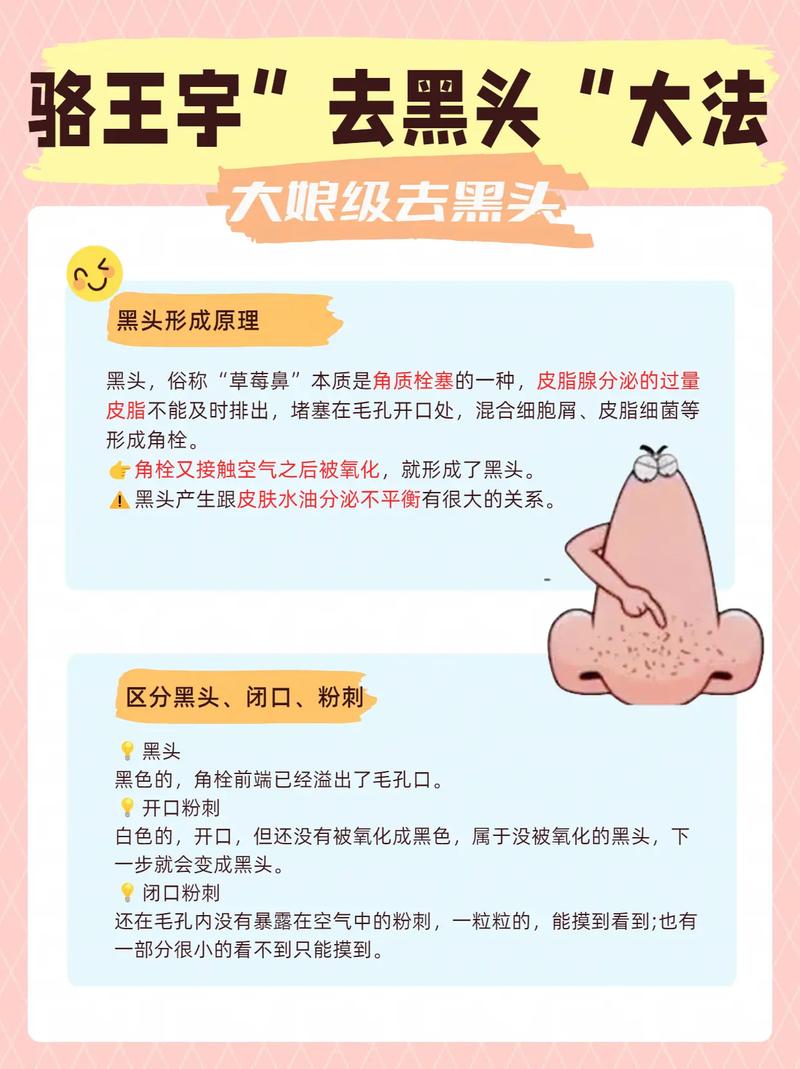 如何去除脸上的黑头？