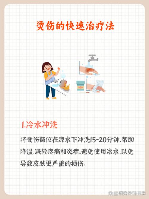 轻微烫伤怎么办？冷水冲 15 分钟 + 涂烫伤膏