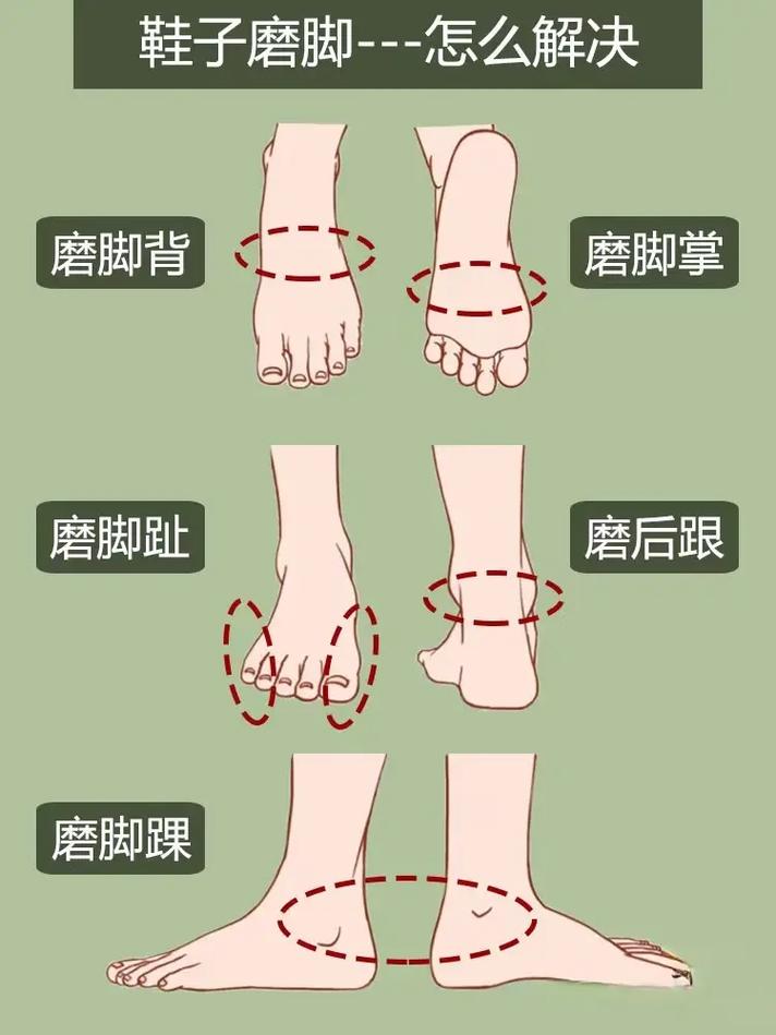 新皮鞋磨脚有什么解决办法？