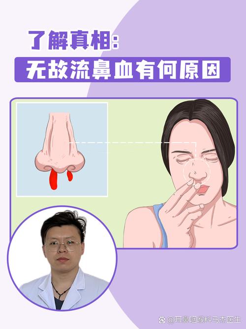 为什么人会流鼻血？