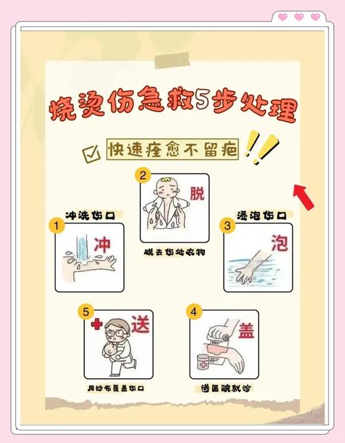 这些烫伤处理误区,可能会加重伤势!
