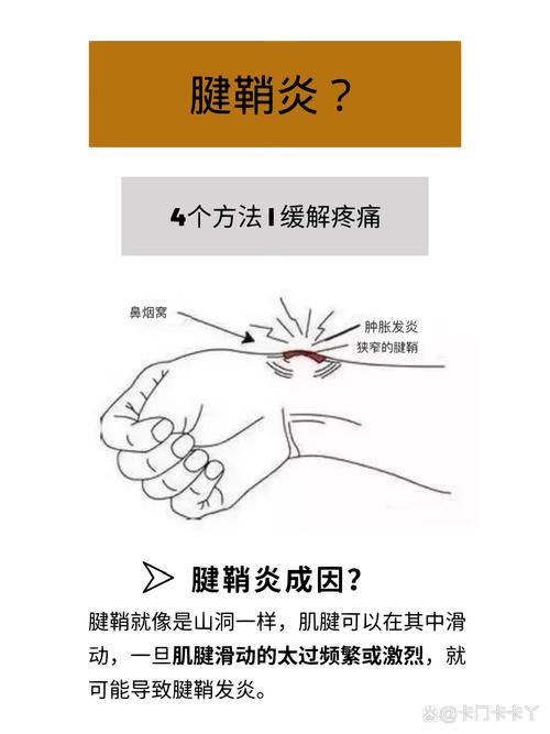 如何缓解手腕酸痛活动时麻木?