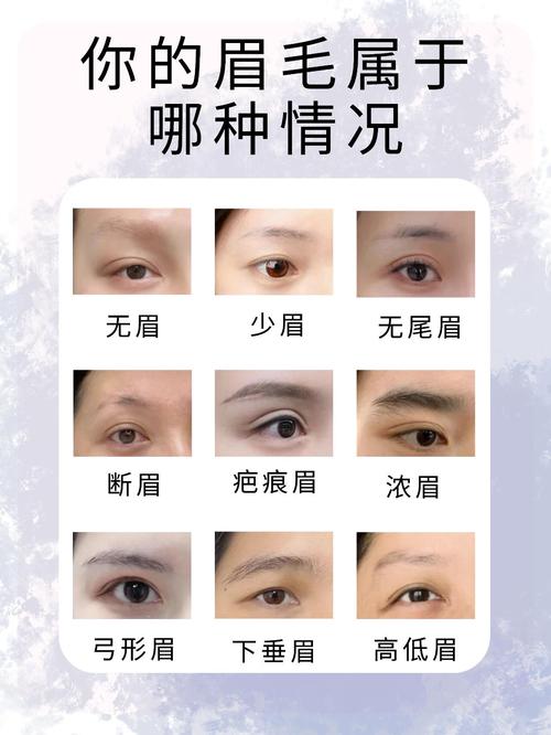 为什么人会有眉毛?