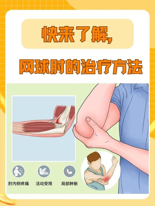 如何缓解肘部酸痛活动时灼痛?