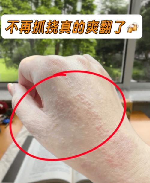 冲锋衣涂层老化判断？指甲刮擦测试