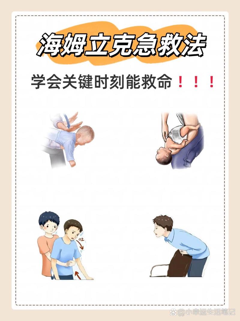海姆立克法手势规范?握拳位置高度