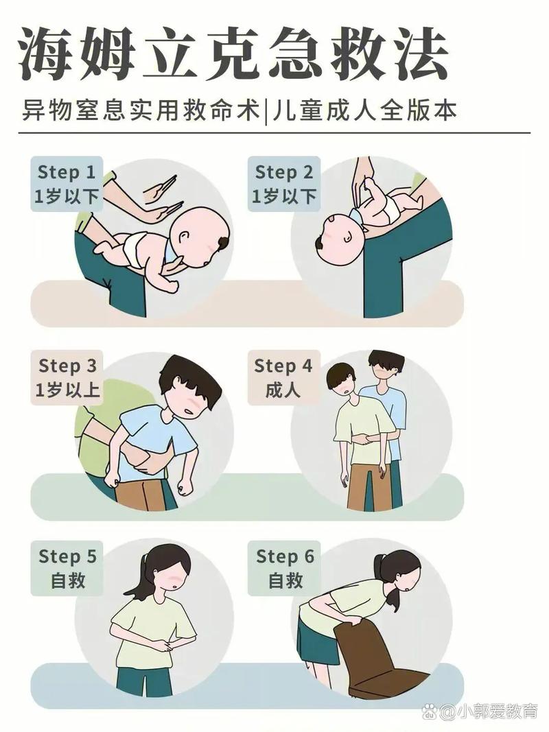 海姆立克急救法操作