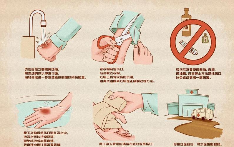 处理轻微烫伤的紧急步骤