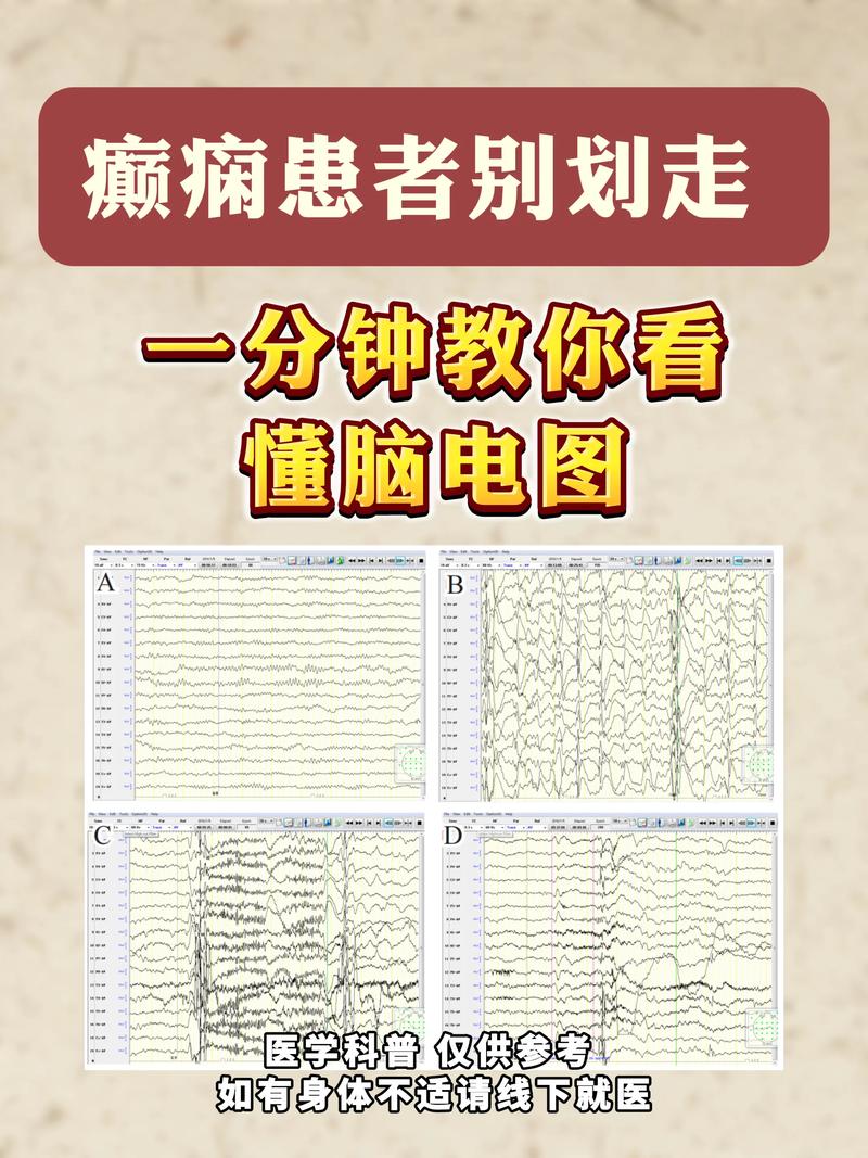 脑电波控制技术离日常生活还有多远?神经工程进展