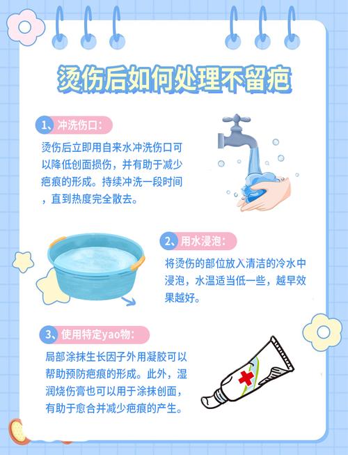 烫伤冷水冲洗时长?20 分钟科学依据